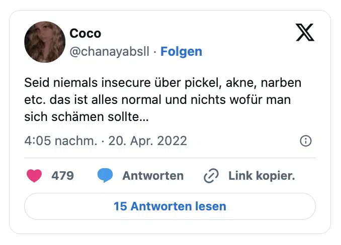 Seid niemals insecure über pickel, akne, narben etc. das ist alles normal und nichts wofür man sich schämen sollte…
