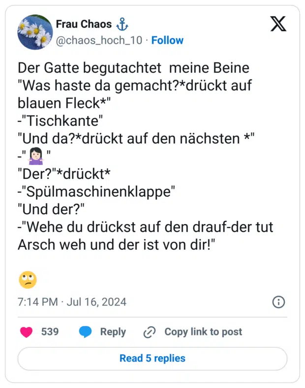 Der Gatte begutachtet  meine Beine
"Was haste da gemacht?*drückt auf blauen Fleck*"
-"Tischkante"
"Und da?*drückt auf den nächsten *"
-"🤷🏻‍♀️"
"Der?"*drückt*
-"Spülmaschinenklappe"
"Und der?"
-"Wehe du drückst auf den drauf-der tut Arsch weh und der ist von dir!"

🙄

