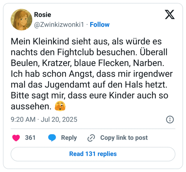 Mein Kleinkind sieht aus, als würde es nachts den Fightclub besuchen. Überall Beulen, Kratzer, blaue Flecken, Narben. Ich hab schon Angst, dass mir irgendwer mal das Jugendamt auf den Hals hetzt. Bitte sagt mir, dass eure Kinder auch so aussehen