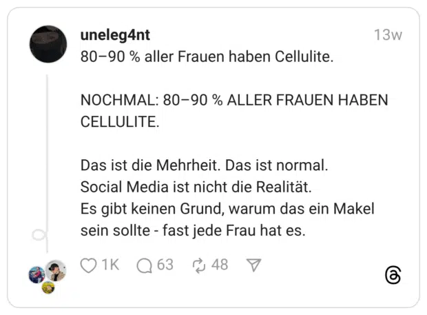 80–90 % aller Frauen haben Cellulite. NOCHMAL: 80–90 % ALLER FRAUEN HABEN CELLULITE. Das ist die Mehrheit. Das ist normal. Social Media ist nicht die Realität. Es gibt keinen Grund, warum das ein Makel sein sollte - fast jede Frau hat es
