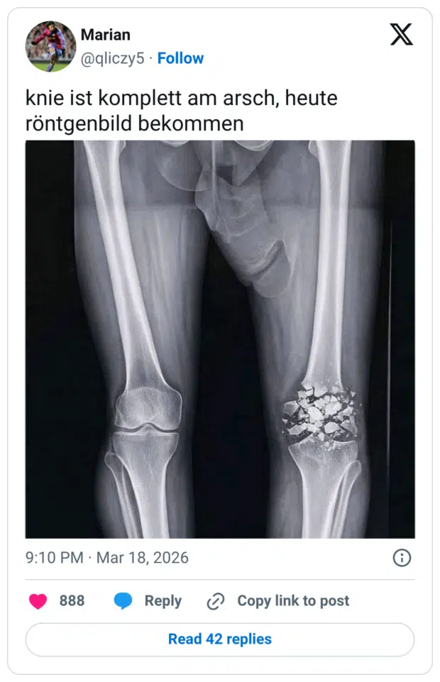 knie ist komplett am arsch, heute röntgenbild bekommen