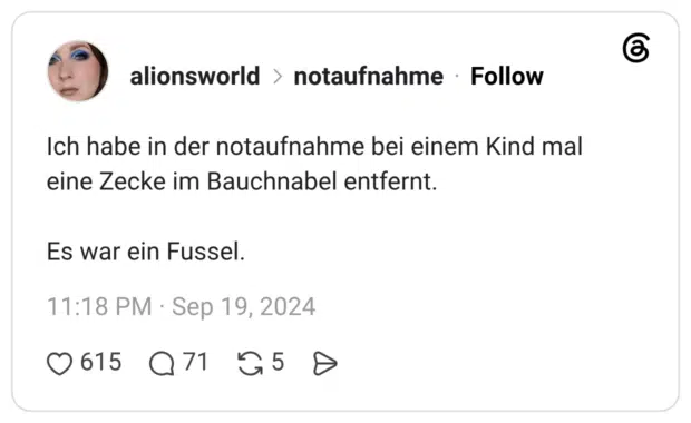 Ich habe in der notaufnahme bei einem Kind mal eine Zecke im Bauchnabel entfernt. Es war ein Fussel.