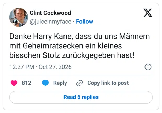 Danke Harry Kane, dass du uns Männern mit Geheimratsecken ein kleines bisschen Stolz zurückgegeben hast!